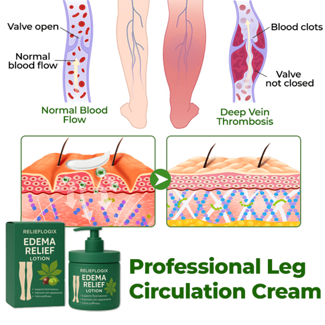Relieflogix Edema Relief Lotion